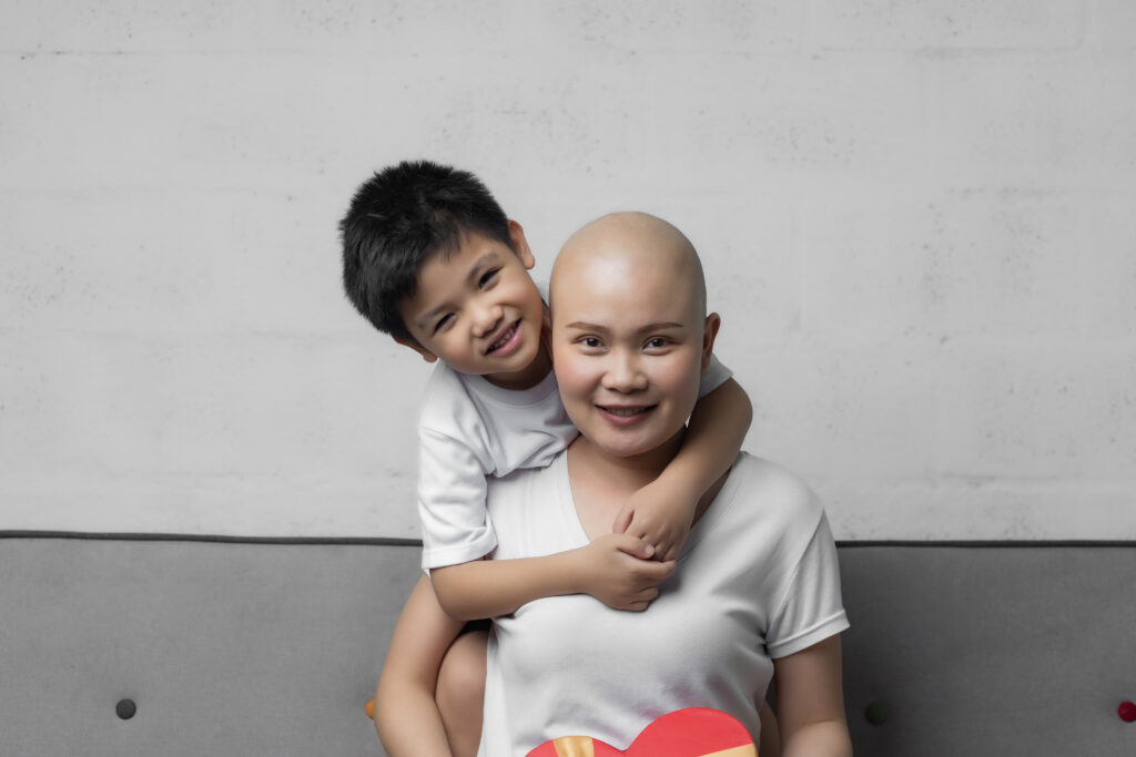 Mother with alopecia and child